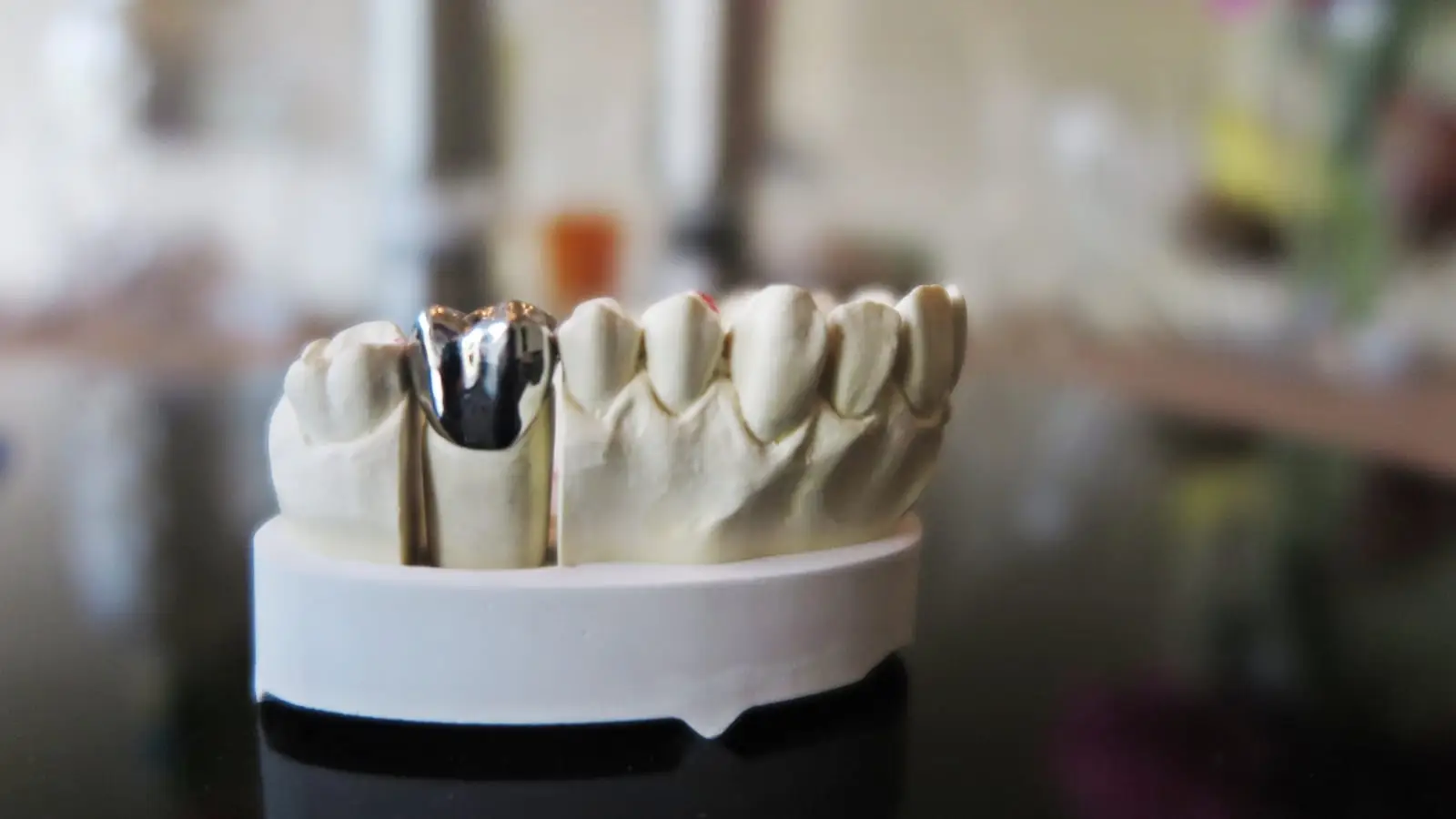 Corona Dentale Turchia, con specialisti partner indipendenti a Istanbul