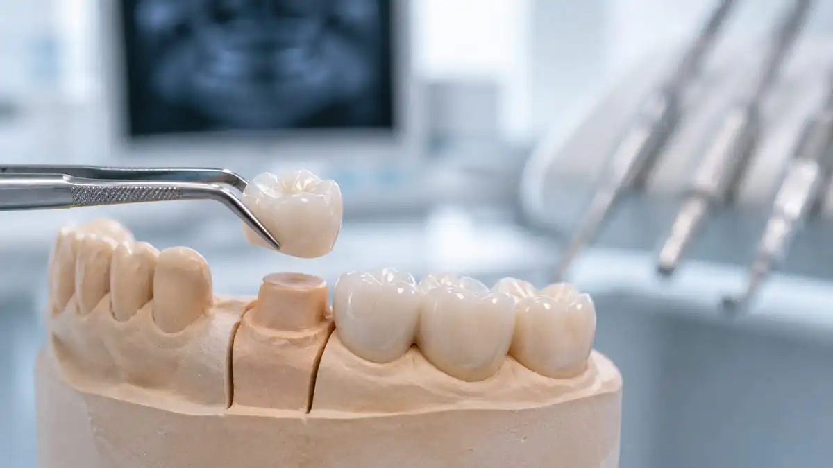 Corona Dentale Turchia, in una clinica partner accreditata a Istanbul