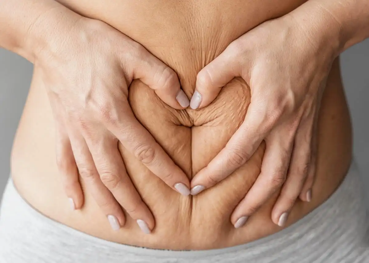 Cirugía de contorno corporal mommy makeover en Turquía con un cirujano asociado certificado en Estambul