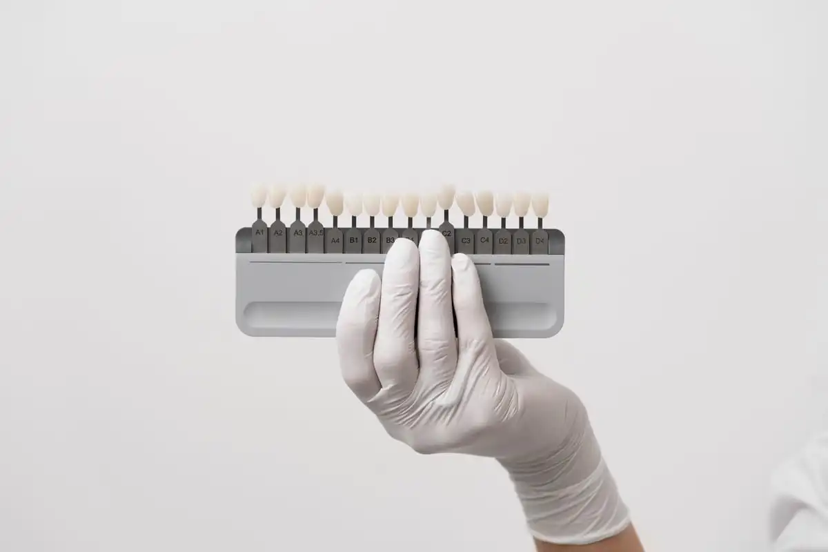 Sbiancamento denti in Turchia, paziente con un sorriso naturale e luminoso dopo uno sbiancamento professionale a Istanbul
