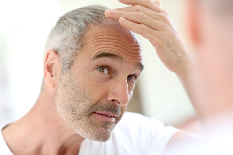 FUE hair transplant in Turkey